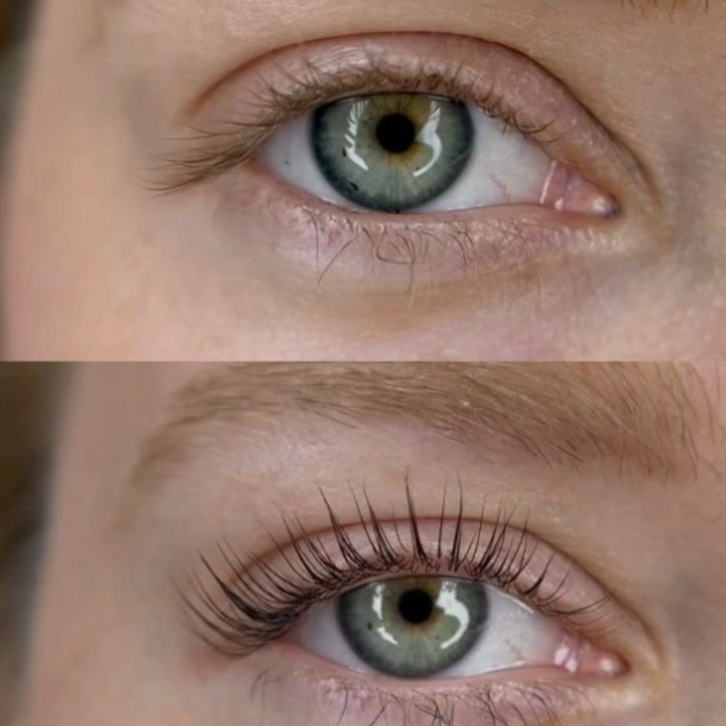 Wimpernlifting