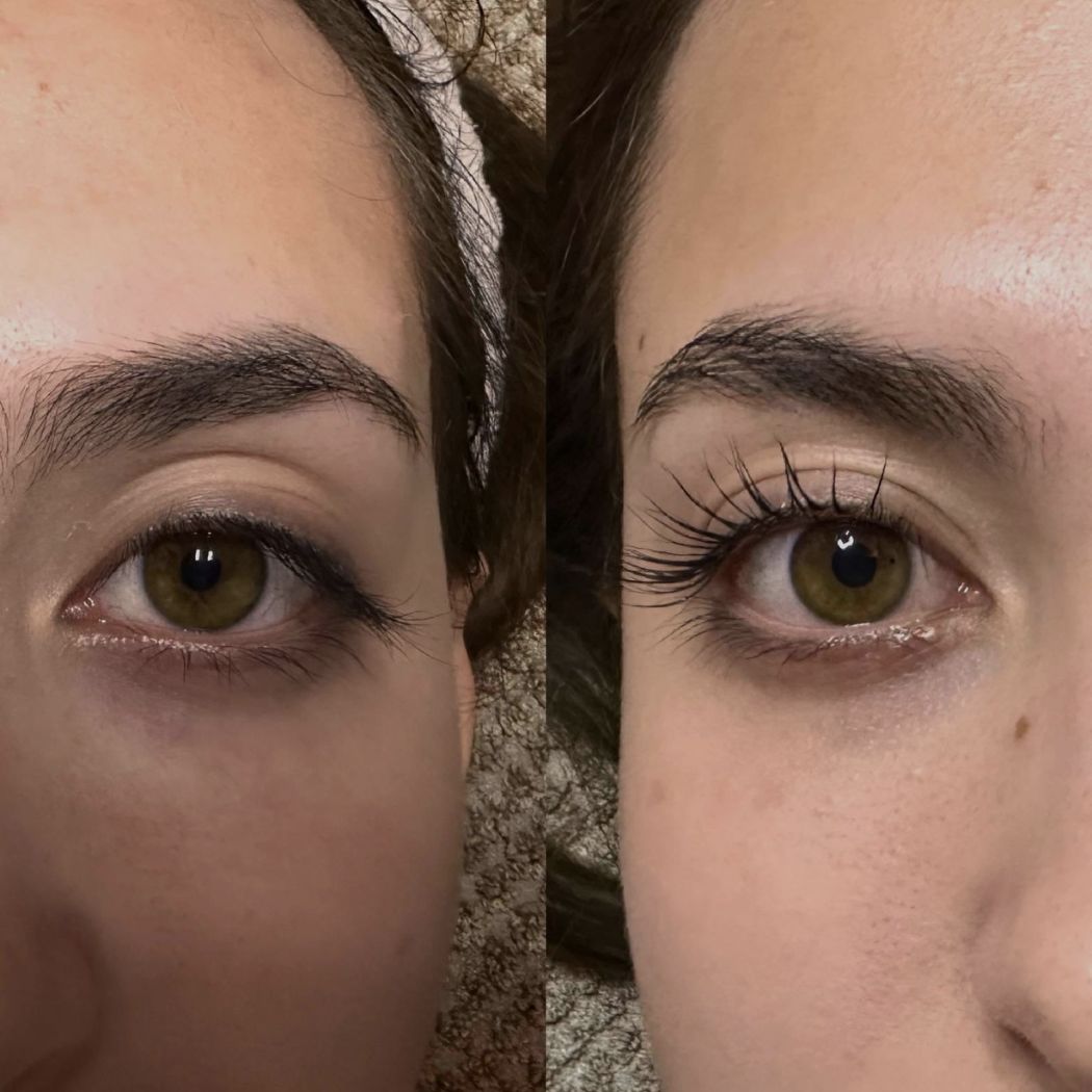 Wimpernlifting